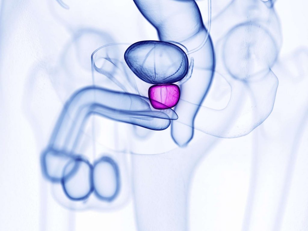 Prostatamassage